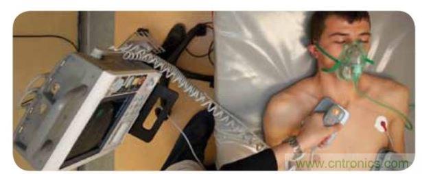 帶電極的醫(yī)院用除顫器。注意，患者身上有外部心電圖或心臟監(jiān)護儀，從胸部的白色圓片(電極)和導聯(lián)(線)可看出來。