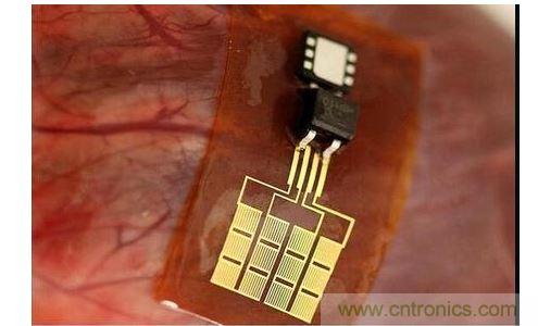 可將人體變成電腦的電子皮膚！