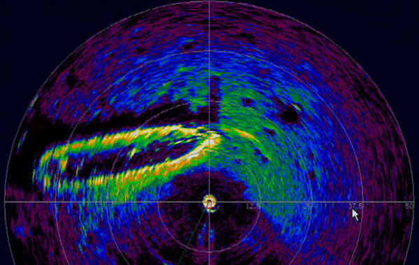 什么是激光雷達以及如何使用它？