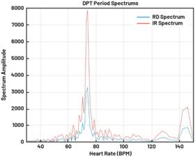 動態(tài)離散周期變換技術突破：無ECG參考的生理信號精準解析