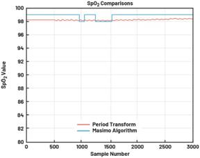 動態(tài)離散周期變換技術突破：無ECG參考的生理信號精準解析