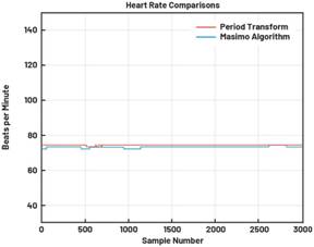 動態(tài)離散周期變換技術突破：無ECG參考的生理信號精準解析