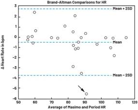 動態(tài)離散周期變換技術突破：無ECG參考的生理信號精準解析