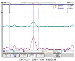 動態(tài)離散周期變換技術突破：無ECG參考的生理信號精準解析