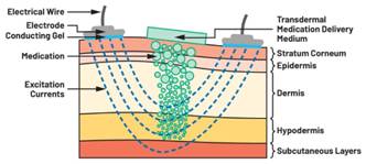  圖5.人體皮膚分層橫截面以及TMD和生物阻抗測量  考慮到生物阻抗分析的無創(chuàng)性，使用兩個金屬電極代表電氣傳感器，連接模擬前端(AFE)電路和患者皮膚。這個金屬與非金屬的接觸點是構(gòu)成整個電路的另一個關(guān)鍵部分，連接了AFE和人體電氣模型。電荷載體（電極中的電子和人體內(nèi)的離子）之間的相互作用可能對這些傳感器的性能產(chǎn)生重大影響，需要根據(jù)每種應(yīng)用進(jìn)行具體考慮。首先，金屬與離子溶液接觸的相互作用導(dǎo)致金屬表面附近溶液中離子濃度的局部變化。這種現(xiàn)象會改變電極下方區(qū)域的電荷中性，導(dǎo)致金屬周圍的電解質(zhì)電位與溶液其余部分不同，從而在金屬和電解質(zhì)主體之間產(chǎn)生一個電位差，即常說的“半電池電位”。其次，注入電流的直流分量會導(dǎo)致電極極化。  表1.各種電極類型和相應(yīng)的半電池電位  金屬及反應(yīng)  半電池電位(V)  Al → Al3+ + 3e- Al → Al3+ + 3e-  –1.706 –1.706  Ni → Ni2+ + 2e- Ni → Ni2+ + 2e-  –0.230 -0.230  H2 → 2H+ + 2e- H2 → 2H+ + 2e-  0.000 (by definition) 0.000（根據(jù)定義）  Ag + Cl- → AgCl + e- Ag + Cl- → AgCl + e-  +0.223 +0.223  Ag → Ag+ + e- Ag → Ag+ + e-  +0.799 +0.799  Au → Au+ + e- Au → Au+ + e-  +1.680 +1.680  這是一種不良現(xiàn)象，往往導(dǎo)致電極性能下降。這些考量表明，電極也需要定義適當(dāng)?shù)碾姎饽Ｐ停▍⒁妶D6）。我們可以將干電極表示為具有三個串聯(lián)元件的電路：一個用于模擬半電池電位(EHC)的直流電源；一個用于模擬金屬和非金屬（人體）之間接觸的RC并聯(lián)電池(Rd||Cd)；以及一個用于模擬電極金屬的電阻Rs。