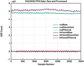 動態(tài)離散周期變換技術突破：無ECG參考的生理信號精準解析